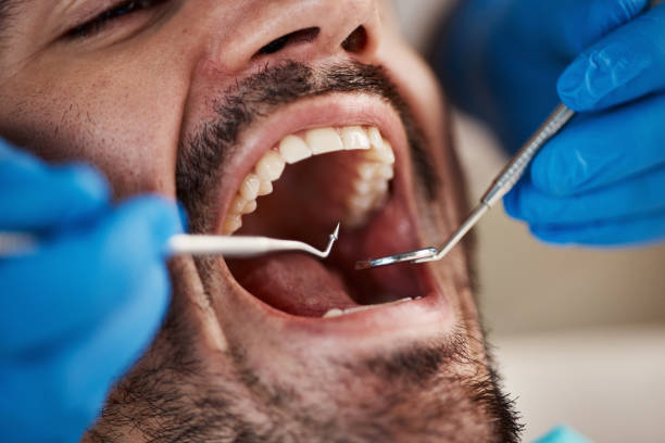Best Emergency Dental Care for Abscessed Tooth in Pleasant Ridge, MI
