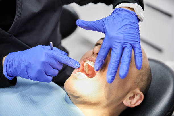 Best Emergency Root Canal Treatment in Pleasant Ridge, MI