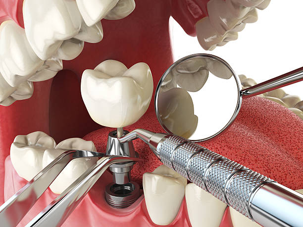 Best Weekend Emergency Dentist in Pleasant Ridge, MI